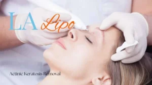 Woman receiving Actinic Keratosis Removal Treatment Birchfield