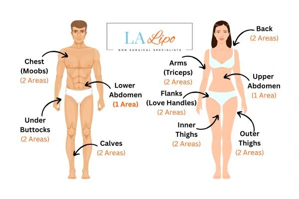 LA LIPO Cryolipolysis Areas Birchfield