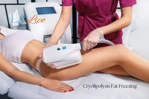 Woman receiving coolsculpting Birchfield treatment on her thighs
