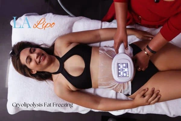 woman getting cryolipolysis Birchfield