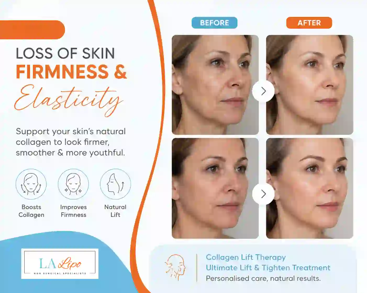 Sign #7: Loss of Skin Firmness and Elasticity Birchfield